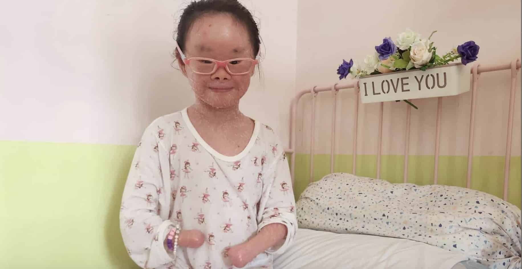 This Singaporean girl with an extremely rare skin condition has beaten the odds to survive and thrive